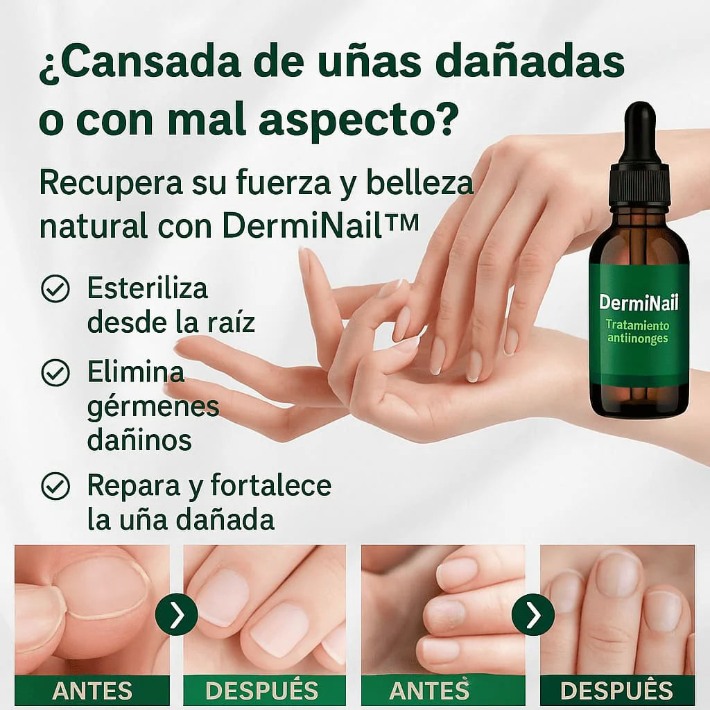 NOSTLIGHT - TRATAMIENTO ANTI HONGOS 7 DÍAS 100% NATURAL