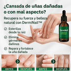 NOSTLIGHT - TRATAMIENTO ANTI HONGOS 7 DÍAS 100% NATURAL