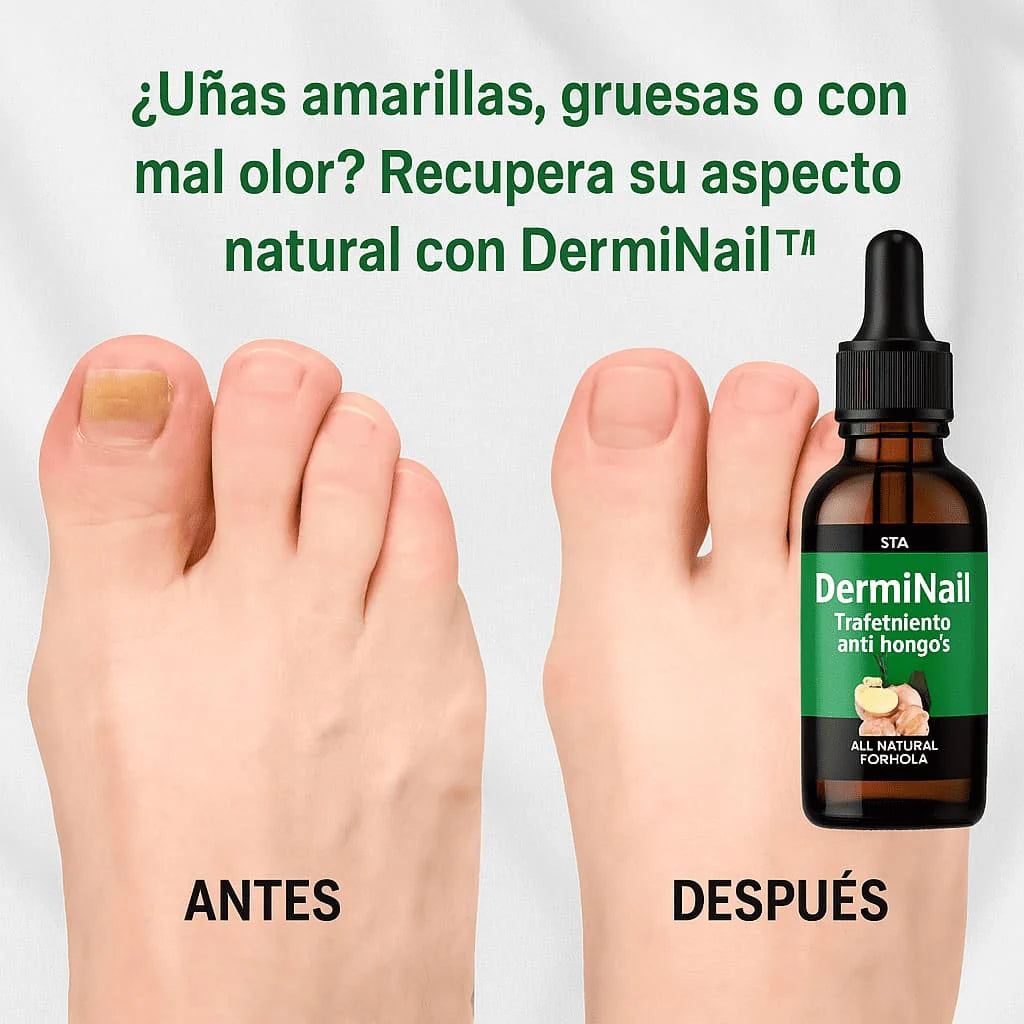 NOSTLIGHT - TRATAMIENTO ANTI HONGOS 7 DÍAS 100% NATURAL